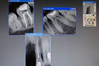Radiografia Digitale - Dott. Andrea Ronconi